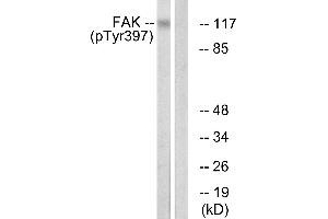Immunohistochemistry analysis of paraffin-embedded human brain tissue using FAK (Phospho-Tyr397) antibody. (FAK Antikörper  (pTyr397))