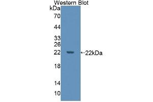 Detection of Recombinant DPPA3, Human using Polyclonal Antibody to Developmental Pluripotency Associated Protein 3 (DPPA3) (DPPA3 Antikörper  (AA 1-159))