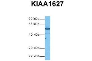 Host:  Rabbit  Target Name:  KIAA1627  Sample Tissue:  Human PANC1  Antibody Dilution:  1. (KIAA1627 Antikörper  (N-Term))