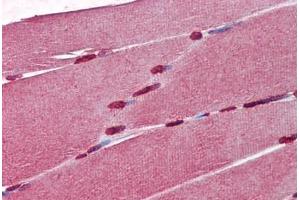 anti-Cellular Retinoic Acid Binding Protein 1 (CRABP1) (AA 1-137) antibody