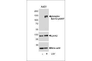 Western blot analysis of lysates from A431 cell line, untreated or treated with EGF, 100 ng/mL, using phospho-EphA2-p A (upper), EphA2 (middle) or Beta-actin (lower). (EPH Receptor A2 Antikörper  (pSer897))