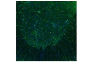 Sample Type :  Spinal Cord, ventral horns (Serotonin Receptor 3B Antikörper  (N-Term))