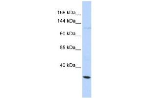 Western Blotting (WB) image for anti-Potassium Large Conductance Calcium-Activated Channel, Subfamily M, alpha Member 1 (KCNMA1) (Middle Region) antibody (ABIN633699)