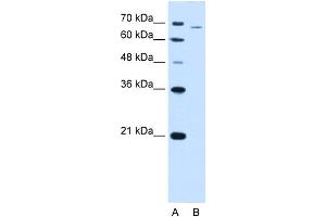 WB Suggested Anti-PFKL Antibody Titration:  2. (PFKL Antikörper  (Middle Region))