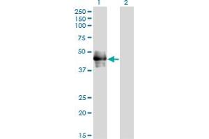 Western Blot analysis of CD177 expression in transfected 293T cell line by CD177 monoclonal antibody (M01), clone 4C4. (CD177 Antikörper  (AA 21-120))