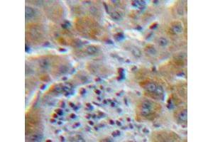 IHC-P analysis of Liver tissue, with DAB staining. (CSF3R Antikörper  (AA 26-138))