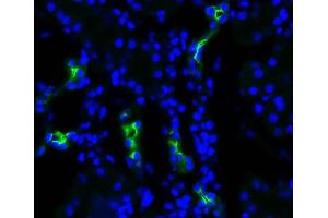 Immunohistochemistry analysis using Rabbit Anti-Aquaporin 2 Polyclonal Antibody . (AQP2 Antikörper  (C-Term) (Atto 488))