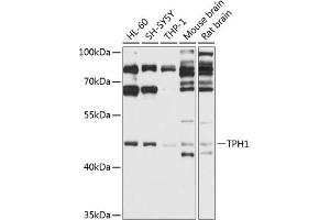 Western blot analysis of extracts of various cell lines, using TPH1 antibody (ABIN3022154, ABIN3022155, ABIN3022156 and ABIN6218634) at 1:1000 dilution. (Tryptophan Hydroxylase 1 Antikörper  (AA 345-444))