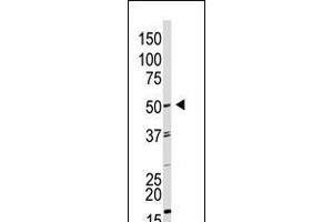 Antibody is used in Western blot to detect GDF9 in HL60 cell lysate. (GDF9 Antikörper  (N-Term))
