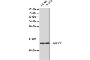 Western blot analysis of extracts of various cell lines using APOC2 Polyclonal Antibody. (Apolipoprotein C-II Antikörper)