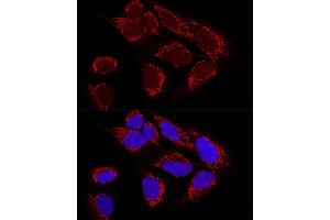 Confocal immunofluorescence analysis of U2OS cells using MTX2 Polyclonal Antibody (ABIN6129694, ABIN6144192, ABIN6144193 and ABIN6223964) at dilution of 1:100. (MTX2 Antikörper  (AA 1-263))