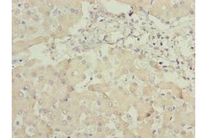 Immunohistochemistry of paraffin-embedded human liver tissue using ABIN7144243 at dilution of 1:100 (ANKRA2 Antikörper  (AA 1-313))