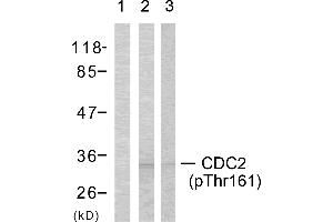 Western blot analysis using CDC2 (Phospho-Thr161) Antibody: Lin: The extracts from COLO cells using preincubated with synthesized phosphopeptide; Lin: The extracts from COLO cells. (CDK1 Antikörper  (pThr161))