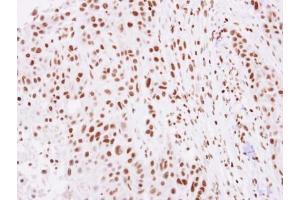 IHC-P Image Immunohistochemical analysis of paraffin-embedded SCC4 xenograft, using Histone H2A.