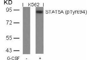 Image no. 1 for anti-Signal Transducer and Activator of Transcription 5A (STAT5A) (pTyr694) antibody (ABIN196697) (STAT5A Antikörper  (pTyr694))
