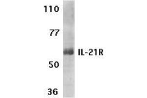 Western blot analysis of IL-21 receptor expression in human Raji cell lysate with AP30415PU-N IL-21 receptor antibody at 1 μg /ml. (IL21 Receptor Antikörper  (N-Term))
