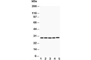 Western blot testing of CD40L antibody and Lane 1:  MCF-7 (CD40 Ligand Antikörper  (N-Term))