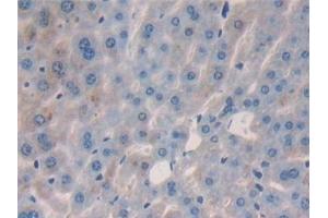 Detection of IL2 in Mouse Liver Tissue using Polyclonal Antibody to Interleukin 2 (IL2) (IL-2 Antikörper  (AA 10-169))