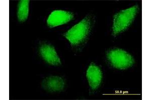 Immunofluorescence of purified MaxPab antibody to FLT3LG on HeLa cell. (FLT3LG Antikörper  (AA 1-235))