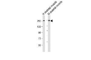All lanes : Anti-MYH6 Antibody (Center) at 1:2000 dilution Lane 1: human skeletal muscle lysate Lane 2: mouse skeletal muscle lysate Lysates/proteins at 20 μg per lane.