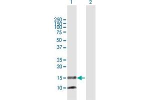 Western Blotting (WB) image for anti-Prostaglandin E Synthase (PTGES) (AA 1-152) antibody (ABIN523024)