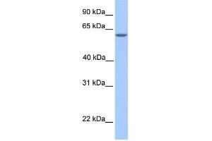 WB Suggested Anti-MTL5 Antibody Titration: 0. (MTL5 Antikörper  (N-Term))