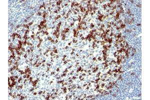 Formalin-fixed, paraffin-embedded human Tonsil stained with PD1 (CD279) Monoclonal Antibody (NAT105). (PD-1 Antikörper)