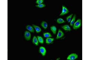 Immunofluorescent analysis of A549 cells using ABIN7153717 at dilution of 1:100 and Alexa Fluor 488-congugated AffiniPure Goat Anti-Rabbit IgG(H+L) (GFRA1 Antikörper  (AA 230-385))