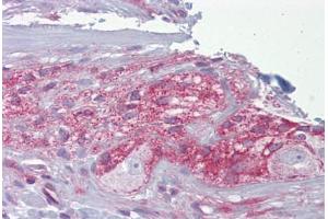 Anti-NCS-1 antibody IHC staining of human small intestine, myenteric plexus. (NCS1 Antikörper  (C-Term))