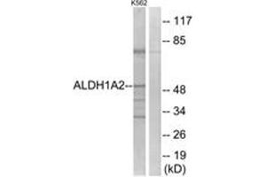 Western blot analysis of extracts from K562 cells, using ALDH1A2 Antibody.