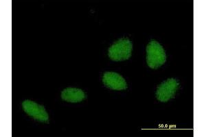 Immunofluorescence of purified MaxPab antibody to ZNF549 on HeLa cell. (ZNF549 Antikörper  (AA 1-640))