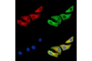 ABIN7096387 and ABIN7100451 staining Hela cells by IF/ICC.