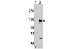 Western blot analysis of TRPM8 (arrow) using rabbit TRPM8 polyclonal antibody . (TRPM8 Antikörper  (AA 933-963))