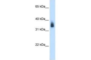 Western Blotting (WB) image for anti-Melanoma Antigen Family A, 8 (MAGEA8) antibody (ABIN2462552) (MAGEA8 Antikörper)