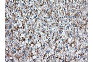Immunohistochemical staining of paraffin-embedded Human prostate tissue using anti-C17orf28 mouse monoclonal antibody. (HID1/DMC1 Antikörper)
