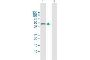 Western Blot analysis of CTBS expression in transfected 293T cell line by CTBS MaxPab polyclonal antibody. (CTBS Antikörper  (AA 1-385))