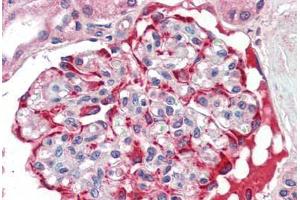 Immunohistochemistry (Paraffin-embedded Sections) (IHC (p)) image for anti-Solute Carrier Family 29 (Nucleoside Transporters), Member 1 (SLC29A1) (AA 234-263) antibody (ABIN462073)