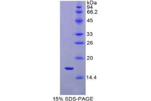 SDS-PAGE analysis of Rat IL1R1 Protein. (IL1R1 Protein)