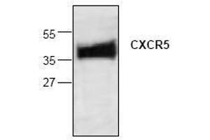 Image no. 1 for anti-Chemokine (C-X-C Motif) Receptor 5 (CXCR5) antibody (ABIN127100) (CXCR5 Antikörper)