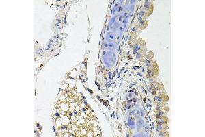 Immunohistochemistry of paraffin-embedded mouse lung using SDC2 antibody at dilution of 1:100 (x40 lens). (Syndecan 2 Antikörper)