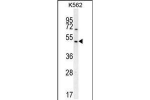 Western blot analysis in K562 cell line lysates (35ug/lane). (RGS7 Antikörper  (C-Term))