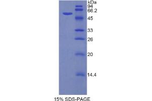 SDS-PAGE analysis of Mouse Hexokinase 2 Protein. (Hexokinase 2 Protein (HK2))