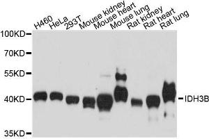 Western blot analysis of extracts of various cell lines, using IDH3B antibody. (IDH3B Antikörper  (AA 35-170))