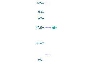 RAB22A Protein (AA 1-194) (GST tag)