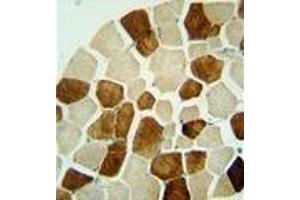 ZSWIM6 antibody (C-term) immunohistochemistry analysis in formalin fixed and paraffin embedded human skeletal muscle followed by peroxidase conjugation of the secondary antibody and DAB staining. (ZSWIM6 Antikörper  (C-Term))