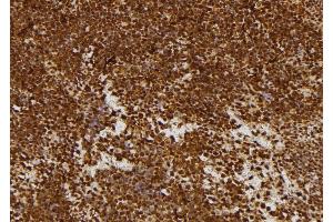 ABIN6277693 at 1/100 staining Mouse spleen tissue by IHC-P.
