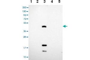 Western blot analysis of Lane 1: RT-4 Lane 2: U-251 MG Lane 3: Human Plasma Lane 4: Liver Lane 5: Tonsil with CEACAM16 polyclonal antibody .