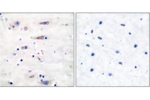 Immunohistochemistry analysis of paraffin-embedded human brain tissue, using NMDAR1 (Ab-897) Antibody. (GRIN1/NMDAR1 Antikörper  (AA 864-913))