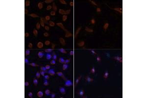 Immunofluorescence analysis of NIH/3T3 cells using MAP1LC3B antibody. (LC3B Antikörper)