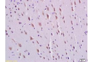 Formalin-fixed and paraffin embedded rat brain labeled with Rabbit Anti-PDGFBB Polyclonal Antibody, Unconjugated  at 1:200 followed by conjugation to the secondary antibody and DAB staining, (PDGF-BB Homodimer (AA 151-241) Antikörper)